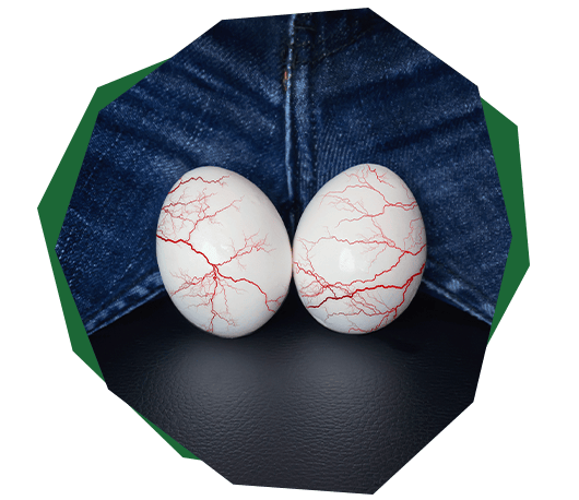 Tips for managing Varicocele Disease