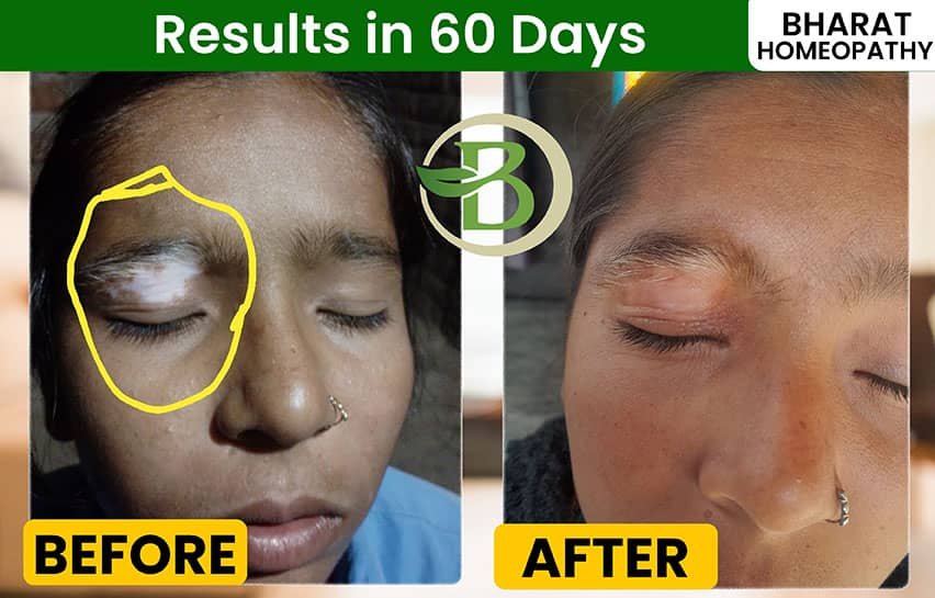 Patient Wellness Diary